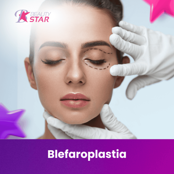 Blefaroplástia